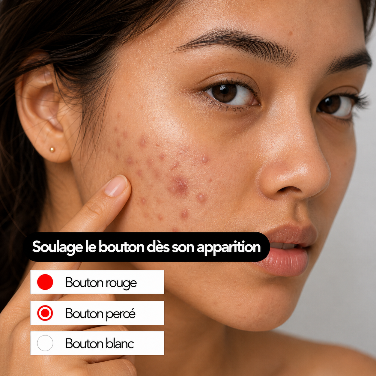 Patchs boutons hydrocolloïde